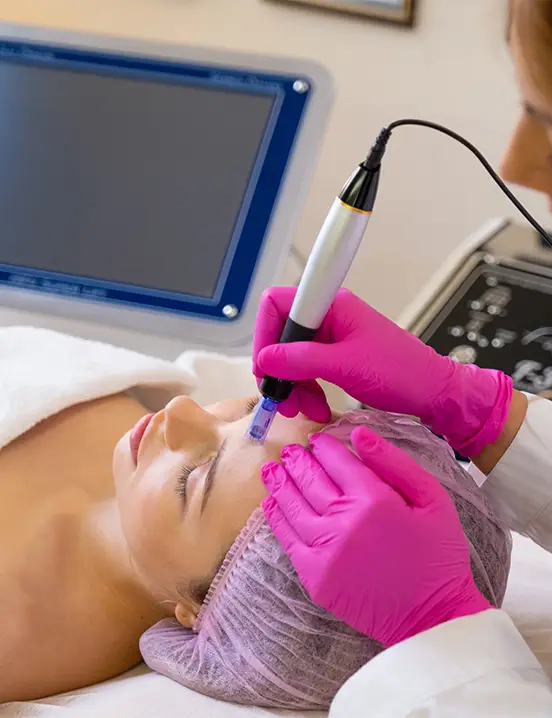 Microneedling Exosome Fusion